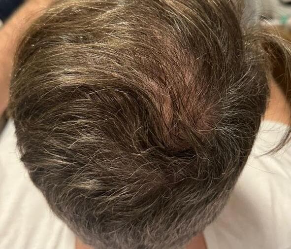 Depois do tratamento